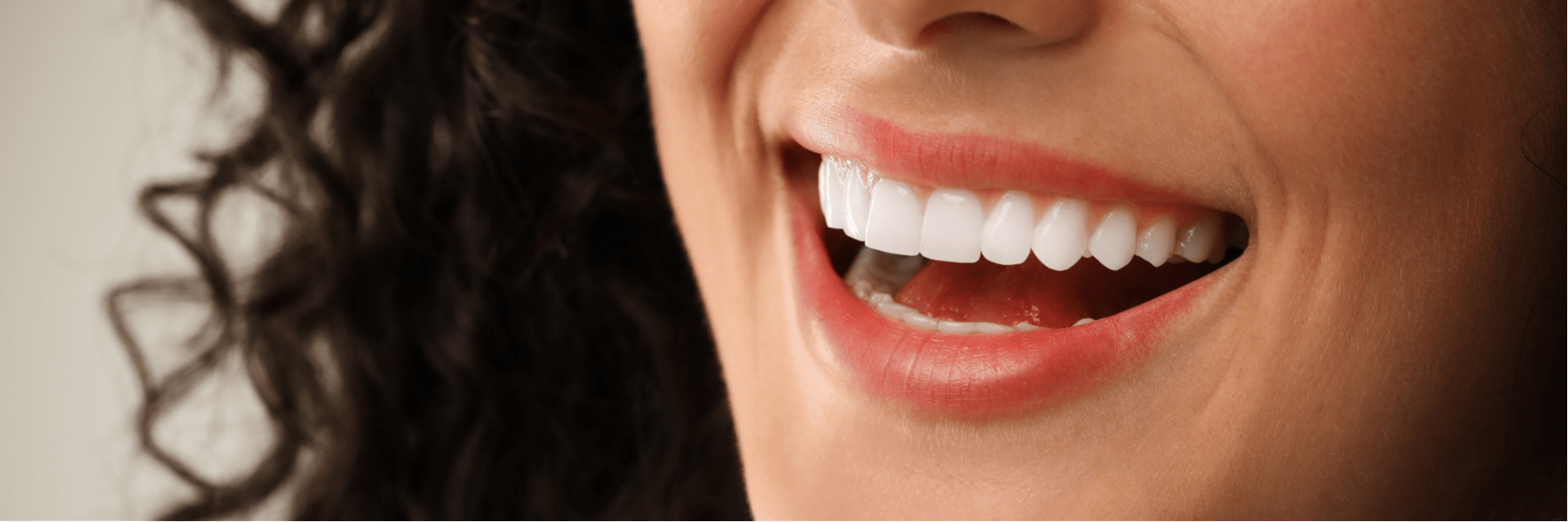 Porcelain Veneers | Dentist