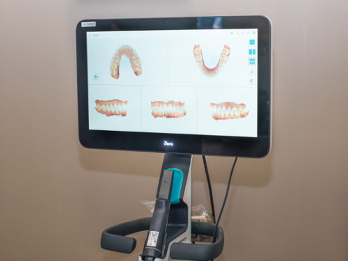 Intraoral Cameras