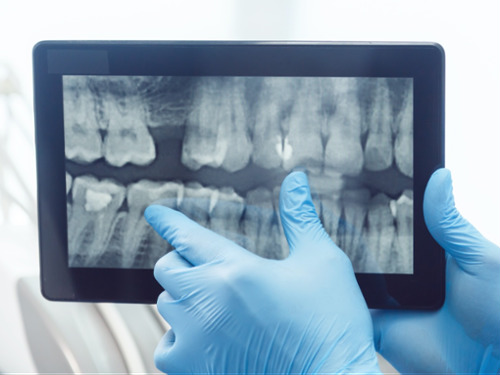 Digital X-Rays