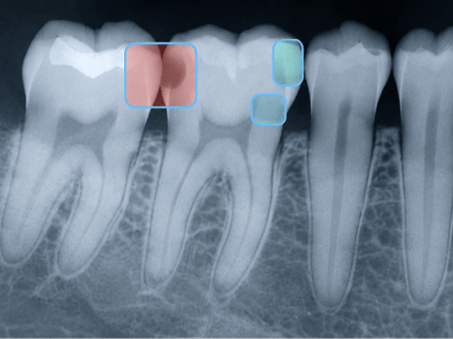AI Radiograph Review